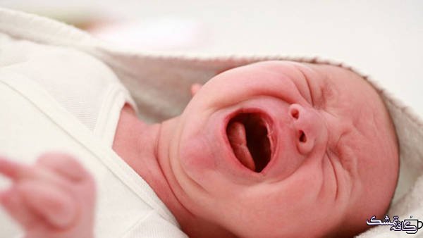 فلوس برای یبوست نوزاد و طریقه مصرف