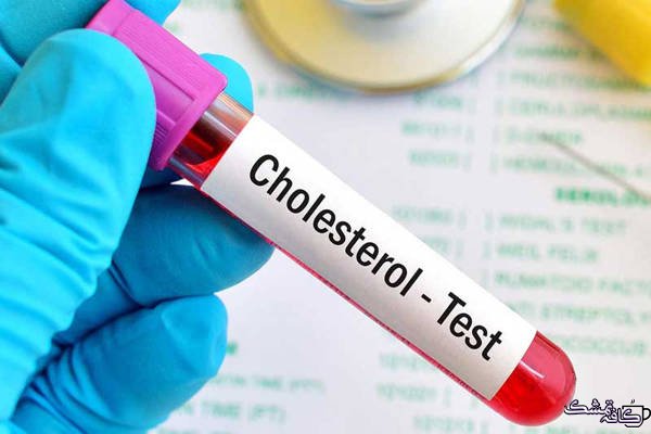 cholesterol test wide - خواص آب انگور در طب سنتی و تاثیر آن بر روی سلامتی و زیبایی